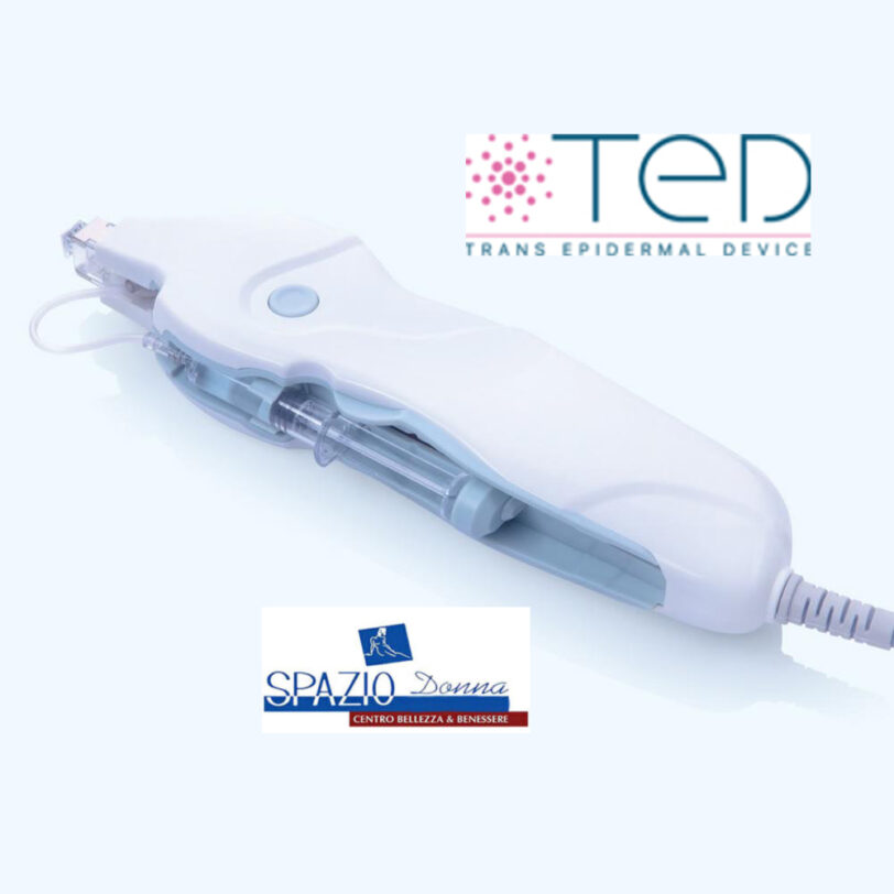 La tecnologia TED - immagine 5