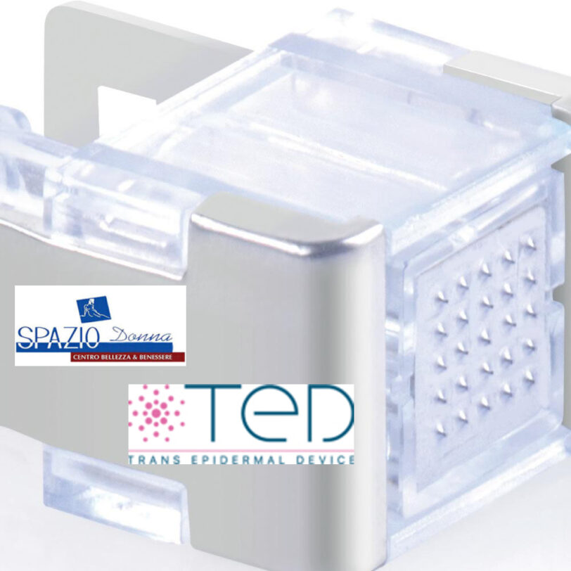 La tecnologia TED - immagine 3